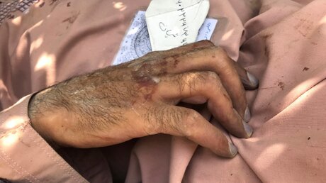 Die Hand eines toten Afghanen nach dem Anschlag am Kabuler Flughafen / © Wali Sabawoon (dpa)