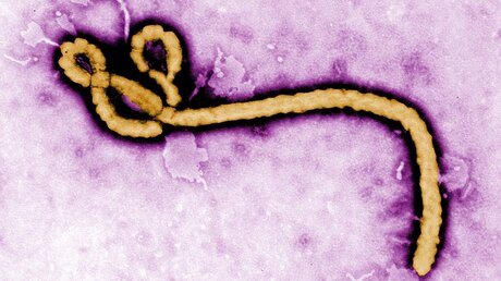 Ebolavirus (dpa)