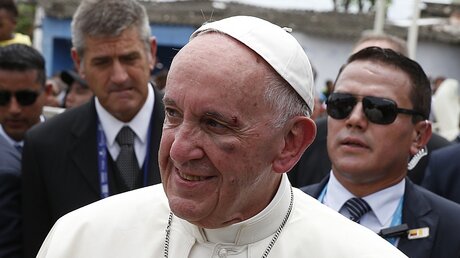 Papst Franziskus mit blauem Auge / © Paul Haring (KNA)