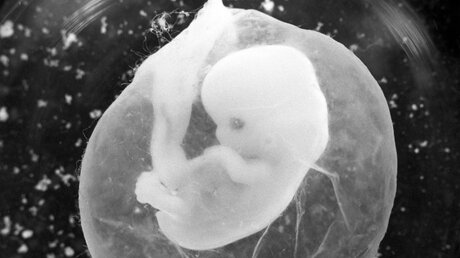 Sieben Wochen alter Fötus in einer Fruchtblase / © Peter Endig (dpa)