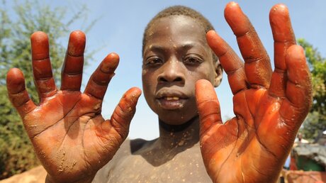 Ein Junge zeigt seine Hände in der Goldmine Poushgin in Zorgho in Burkina Faso (dpa)