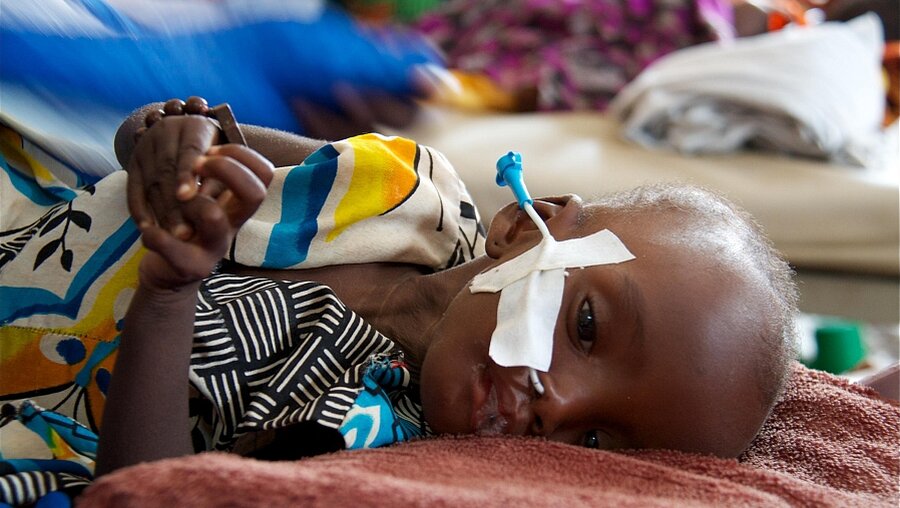 Hungerndes Kind in der Zentralafrikanischen Republik (dpa)