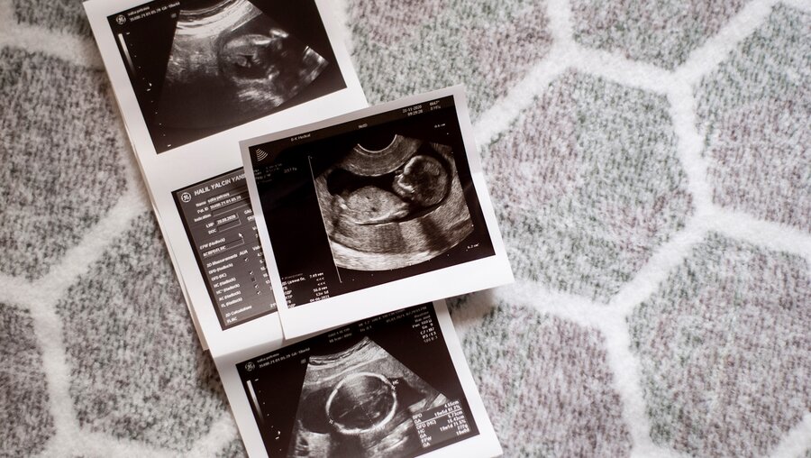 Ultraschallbilder eines ungeborenen Kindes. / © Sofiia.P (shutterstock)