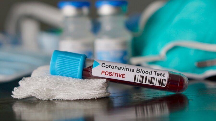 Symbolbild: Bluttest Coronavirus / © SamaraHeisz5 (shutterstock)