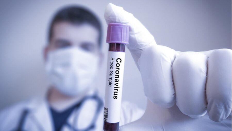 Test auf das Coronavirus (shutterstock)