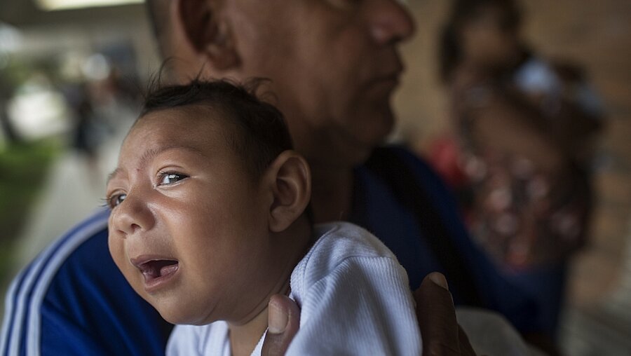 An Mikrozephalie erkranktes Kind / © Rafael Fabres (dpa)