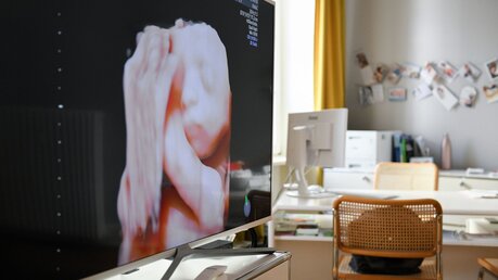 Ultraschallbild eines Ungeborenen auf einem Monitor während einer Ultraschalluntersuchung in einer Praxis für Pränataldiagnostik / ©  Julia Steinbrecht (KNA)