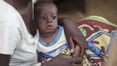 Mangelernährung ist etwa in Malawi ein Problem / © Chipiliro Khonje (dpa)