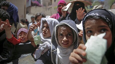 Hungersnot im Jemen / © Hani Mohammed/AP/dpa (dpa)