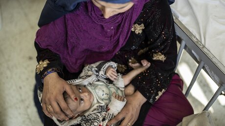 Eine Frau hält ihr unterernährtes Baby in den Armen. / © Petros Giannakouris/AP (dpa)