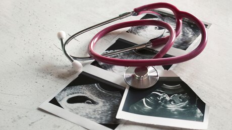 Ultraschallbilder und ein Stethoskop / © Natalya Lys (shutterstock)