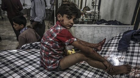 Verzweifelte Lage in Syrien / © Mohammed Badra (dpa)