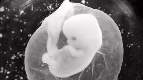 Sieben Wochen alter F&ouml;tus in einer Fruchtblase / &copy; Peter Endig (dpa)