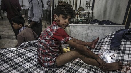 Junge in einem Krankenhaus in Douma, Syrien / © Mohammed Badra (dpa)