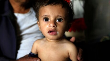 Yahya ist neun Monate alt und wird von Unicef im Jemen versorgt   (Unicef)