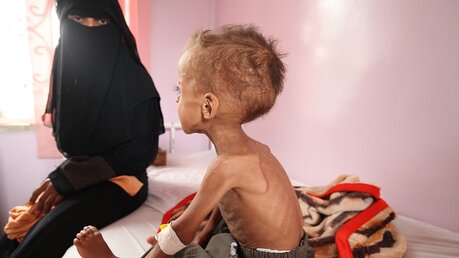 Ein unterernährter Junge im Jemen  / © Unicef/NOTIMEX (dpa)