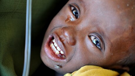 Hungerndes Kind in Afrika (dpa)